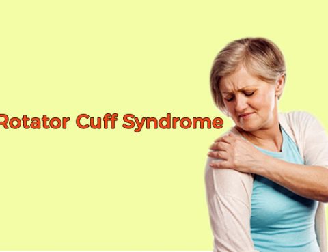 Rotator Cuff Syndrome