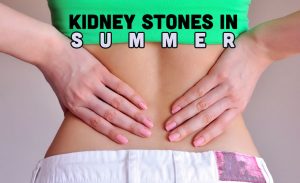 Kidney Stones in Summer