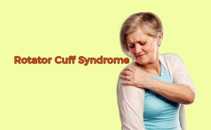 Rotator Cuff Syndrome