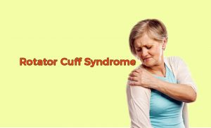 Rotator Cuff Syndrome