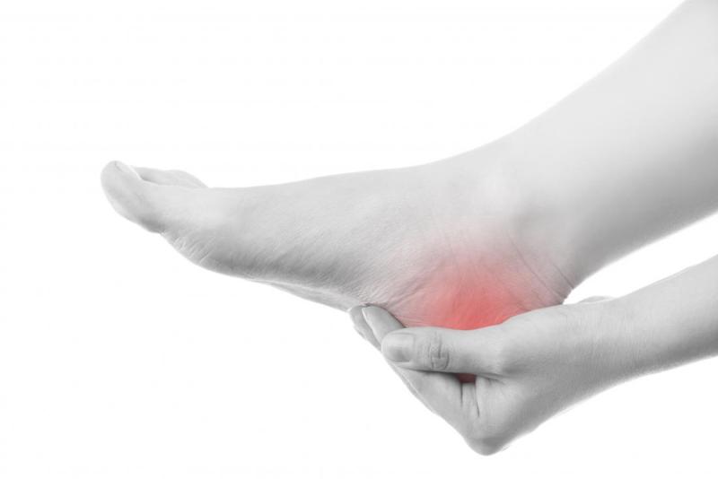 Heel Spur Homeopathy Treatment