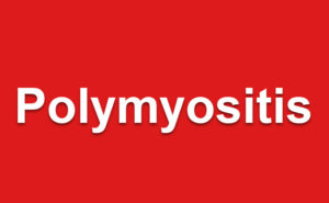Polymyositis - Symptoms, Causes and Homeopathy Treatment