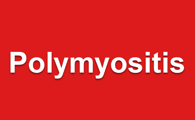 Polymyositis – Symptoms, Causes and Homeopathy Treatment