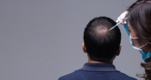 Effective Homeopathic Cure for Hair Loss