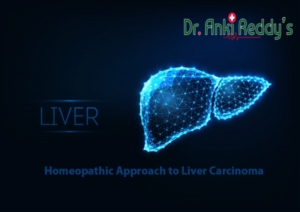 Homeopathic Approach to Liver Carcinoma