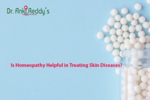 Is Homeopathy Helpful in Treating Skin Diseases?