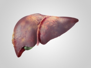 Homeopathy Treatment for Liver Disease