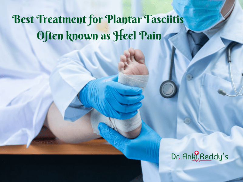 Best Treatment for Plantar Fasciitis Often known as Heel Pain