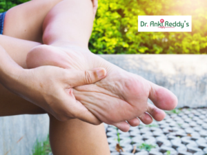 Best Treatment for Plantar Fasciitis Often known as Heel Pain