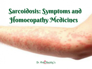 Sarcoidosis: Symptoms and Homoeopathy Medicines 