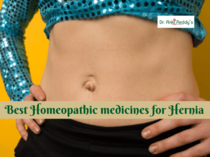 Best Homeopathic medicines for Hernia