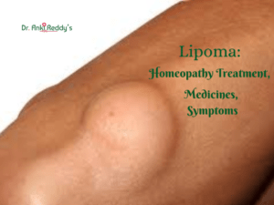 Lipoma: Homeopathy Treatment, Medicines, Symptoms