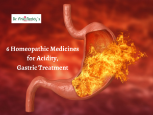6 Homeopathic Medicines for Acidity, Gastric Treatment 