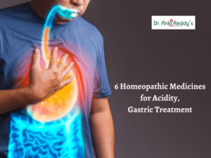 6 Homeopathic Medicines for Acidity, Gastric Treatment