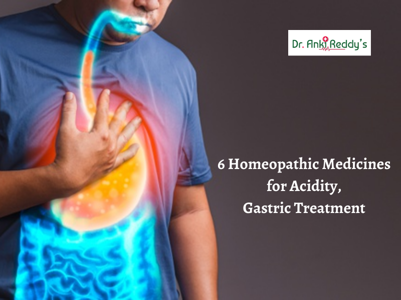 6 Homeopathic Medicines for Acidity, Gastric Treatment