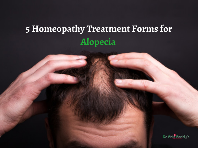 5 Homeopathy Treatment Forms for Alopecia