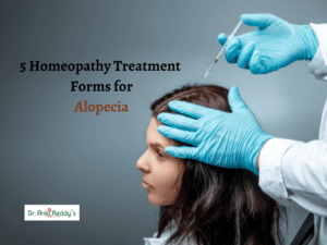 5 Homeopathy Treatment Forms for Alopecia