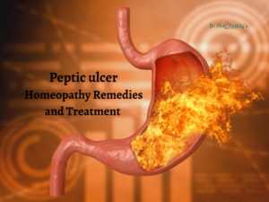 Peptic ulcer Homeopathy Remedies and Treatment