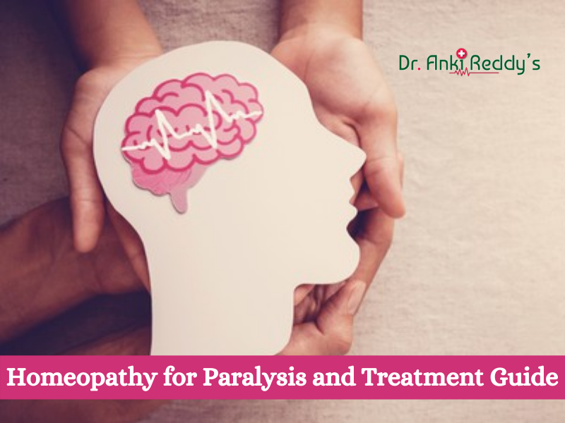 Homeopathy for Paralysis and Treatment Guide