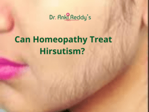 Can Homeopathy Treat Hirsutism?