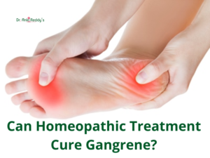 Can Homeopathic Treatment Cure Gangrene?