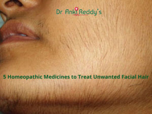 5 Homeopathic Medicines to Treat Unwanted Facial Hair