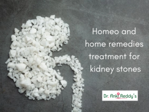 Homeo and home remedies treatment for kidney stones