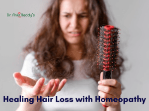 Healing Hair Loss with Homeopathy