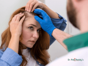 Healing Hair Loss with Homeopathy