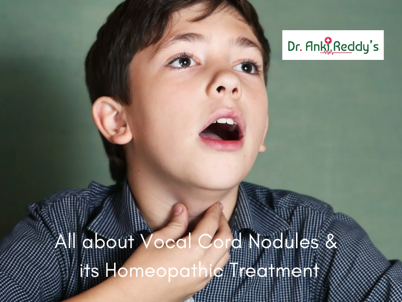 All about Vocal Cord Nodules & its Homeopathic Treatment