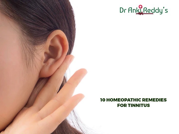 10 Homeopathic Remedies for Tinnitus  