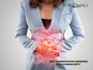 Best Homeopathic Remedies for Hyperacidity