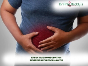 Effective Homeopathic Remedies for Esophagitis