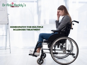 Homeopathy for Multiple Sclerosis Treatment