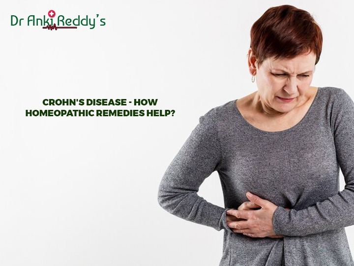 Crohn's Disease - How Homeopathic Remedies Help?