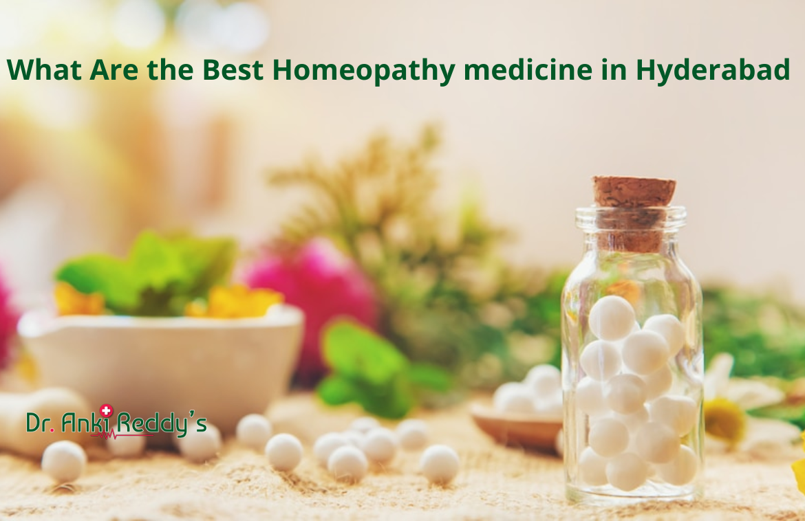What Are the Best Homeopathy medicine in Hyderabad