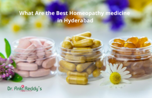 What Are the Best Homeopathy medicine in Hyderabad