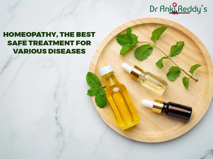 Homeopathy, the best, safe treatment for various diseases