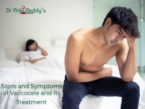 Signs and Symptoms of Varicocele and its Treatment