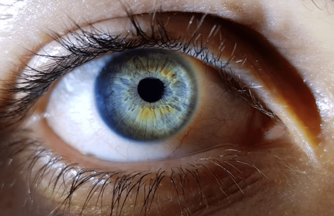 Uveitis-its causes, symptoms and treatments