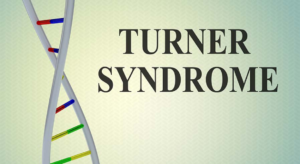 Turner’s Syndrome: Types, Symptoms, and Treatments