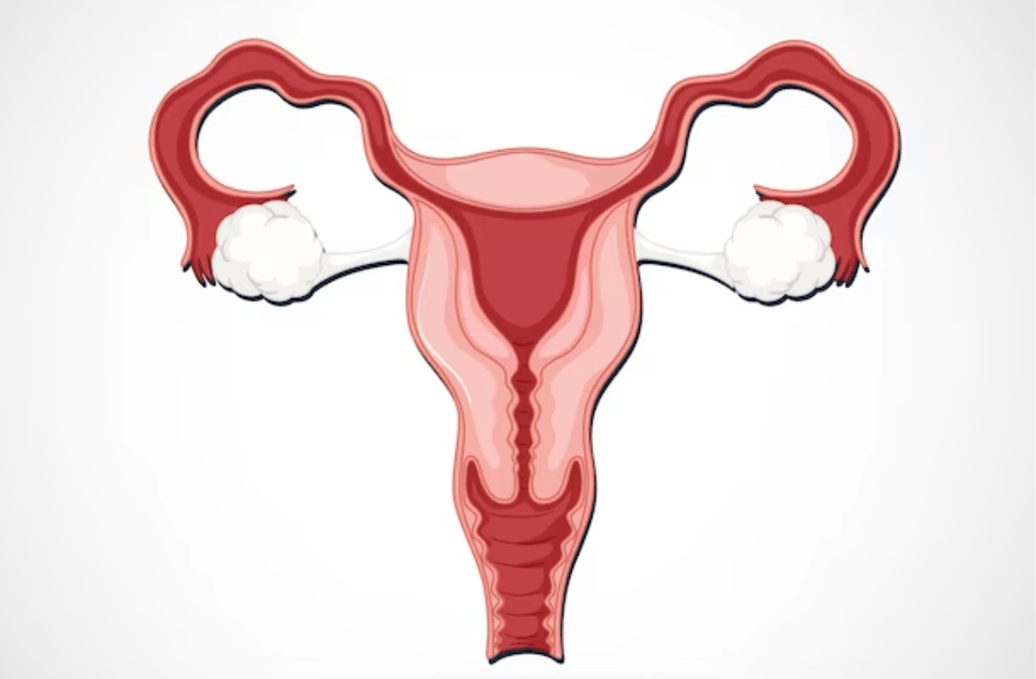 Uterine fibroids- symptoms, causes, and treatments