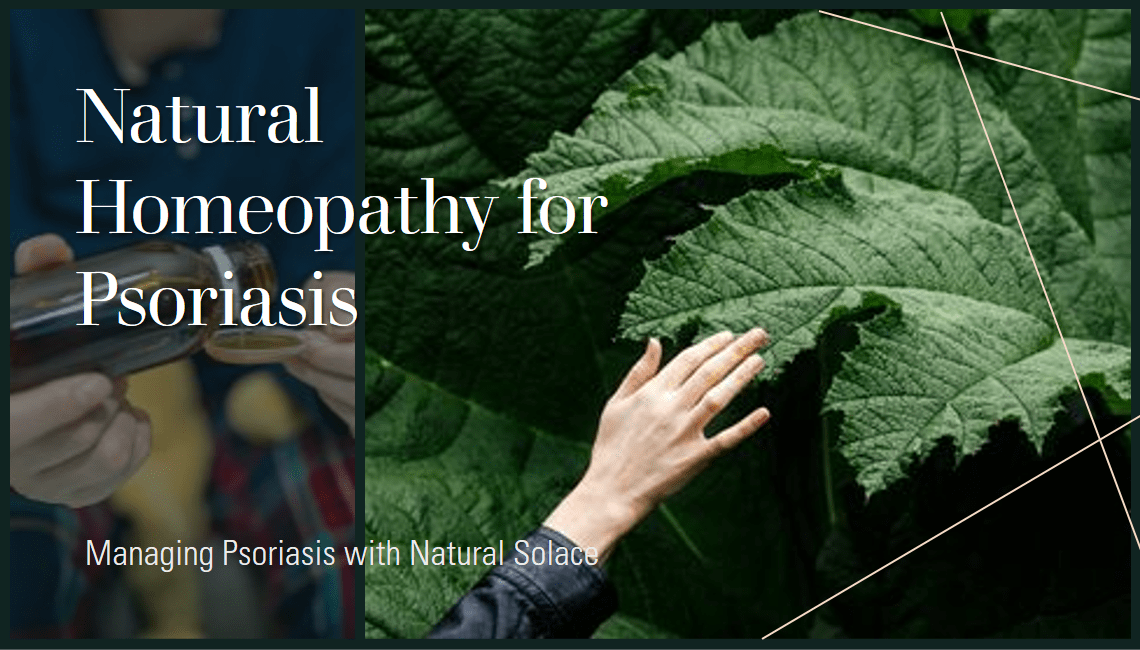 Natural Solace Homeopathy for Psoriasis