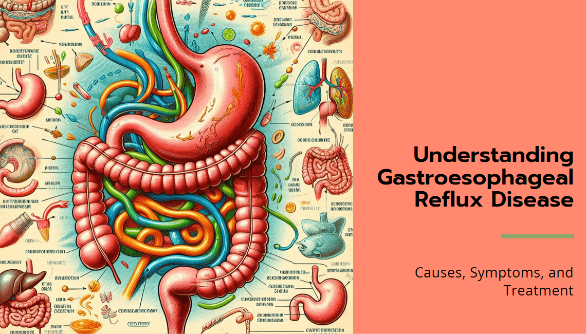 treatment of gastroesophageal reflux disease