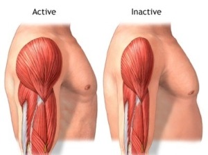 Understanding Polymyositis Causes and Risk Factors